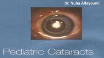 <p>
	<a href="http://syrianmonster.com/portfolio/data/Pediatric%20cataracts.pps">Pediatric cataracts</a></p>

